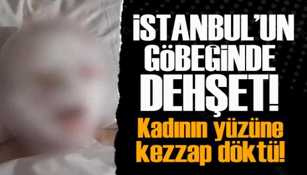 Görüşme teklifini reddeden kadının yüzüne kezzap döktü