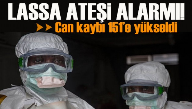 Lassa ateşi alarmı: Can kaybı 151’e yükseldi