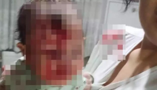 4 aylık bebeğini sehpaya fırlattı!