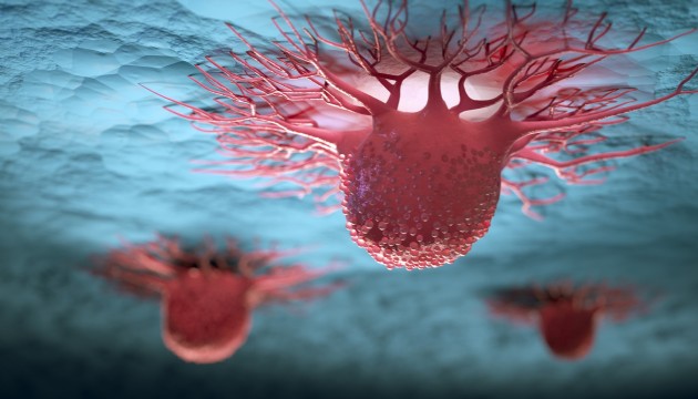 Bilim insanlarından çığır açan keşif: Kolera bakterisi kanser hücrelerini öldürüyor