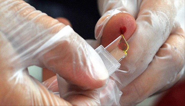 Ölüm saçan kan grubu ortaya çıktı