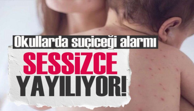 Okullarda 'suçiçeği' alarmı: Sessizce yayılıyor, belirtilere dikkat!