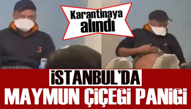 İstanbul'da maymun çiçeği paniği: Karantinaya alındı