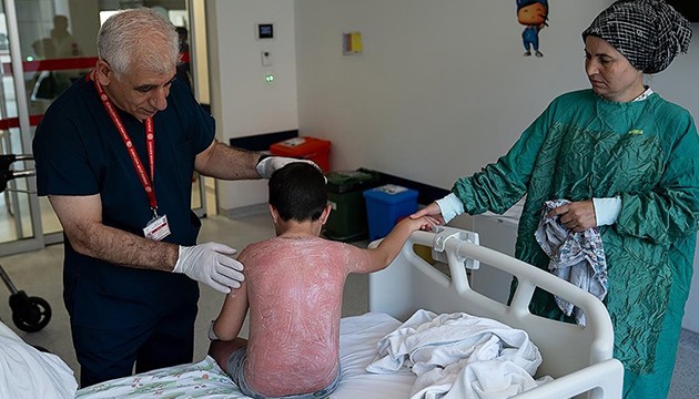 Güneşte 4 saat kaldı, hastanelik oldu