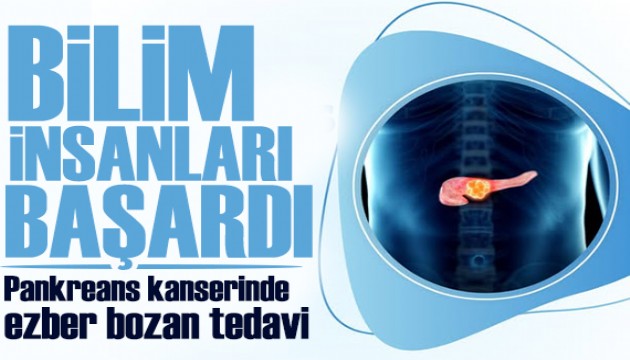 Bilim insanları başardı! Pankreas kanserinde ezber bozan tedavi!