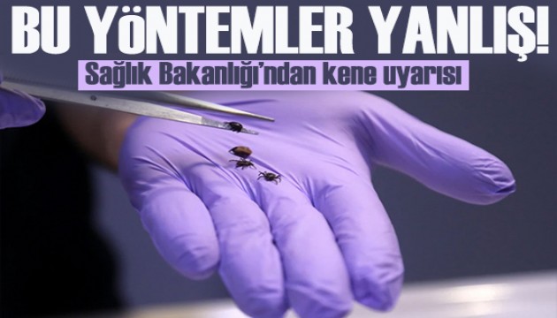 Sağlık Bakanlığı’ndan kene uyarısı! Bu yöntemleri denemeyin!