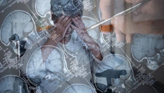 Alzheimer'a karşı bakır kalkanı: Fare deneylerinde zehirli proteinler yüzde 42 azaldı