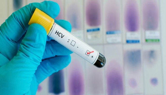 Hepatit C uyarısı: Risk gruplarına dikkat!