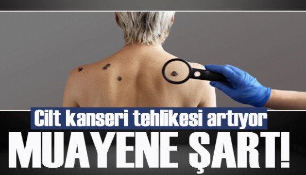 Uzmanı uyardı: Cilt kanseri tehlikesi artıyor