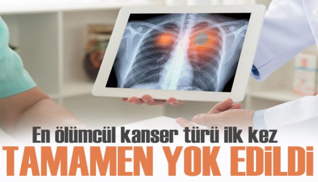 En ölümcül kanser türü ilk kez tamamen yok edildi