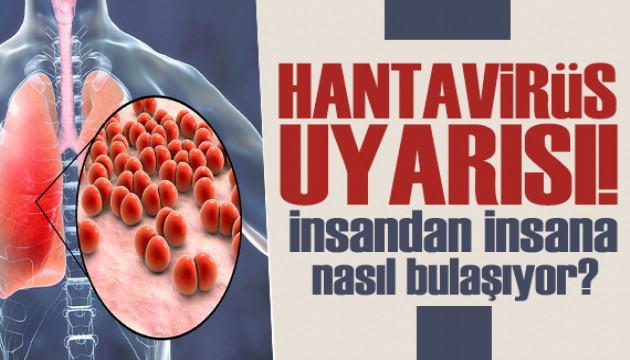 Hantavirüse karşı kritik uyarı: İnsandan insana nasıl bulaşıyor?
