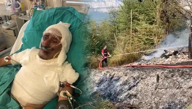 Korkunç iddia! Kardeşini diri diri yaktı
