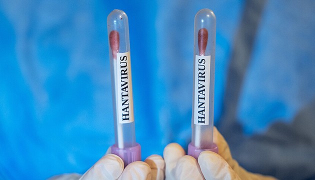 ABD'den hantavirüs adımı